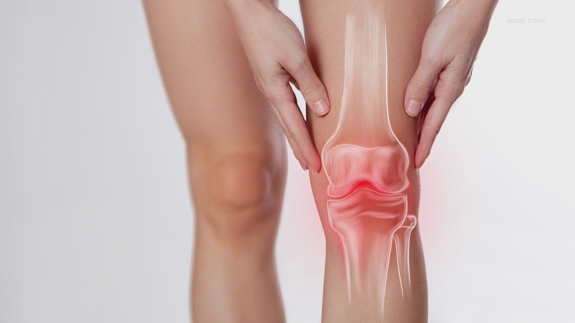 A FIFA-funded study at Kingston University will investigate whether hormonal fluctuations during menstrual cycles could be contributing to knee injuries in women